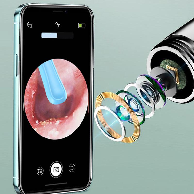 🏆Heißer Verkauf👂Visuelles elektrisches Ohrenschmalz-Entfernungsgerät