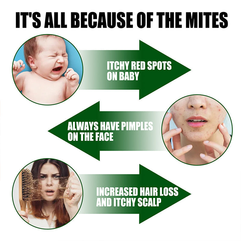 🔥🔥Hochwirksames Anti-Milben-Spray❌🦠