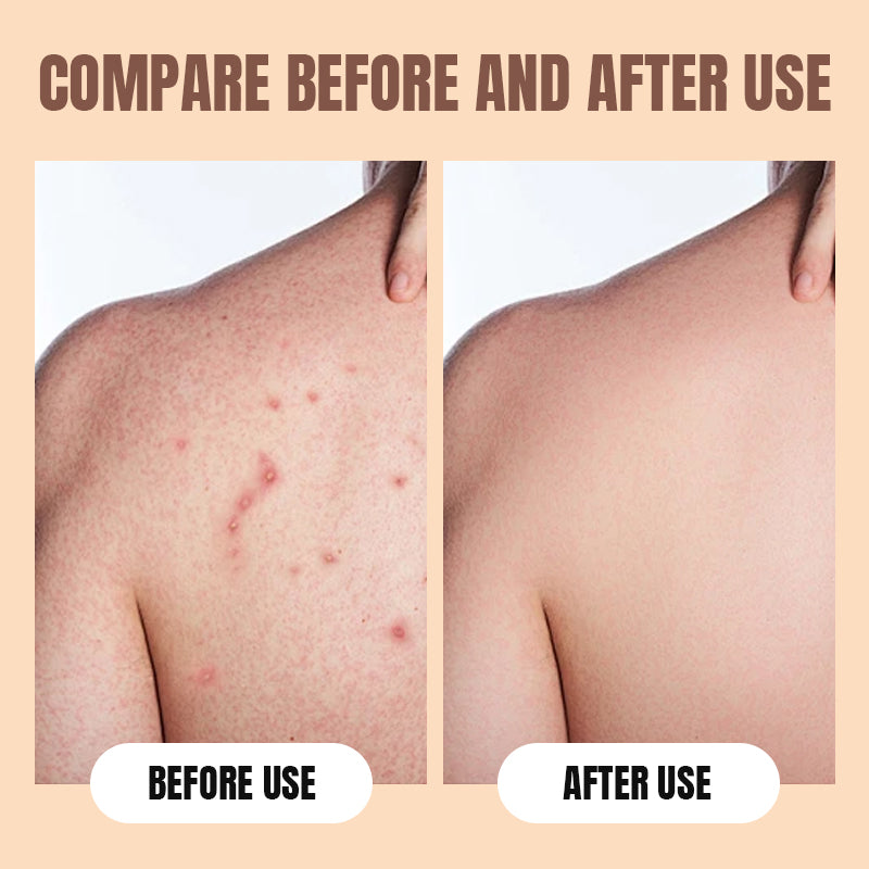 Tiefenreinigendes, feuchtigkeitsspendendes Schwefel-Duschgel