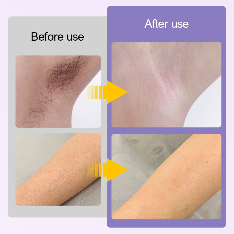 Elektrischer 2-in-1-Doppelkopf-Haartrimmer für Frauen