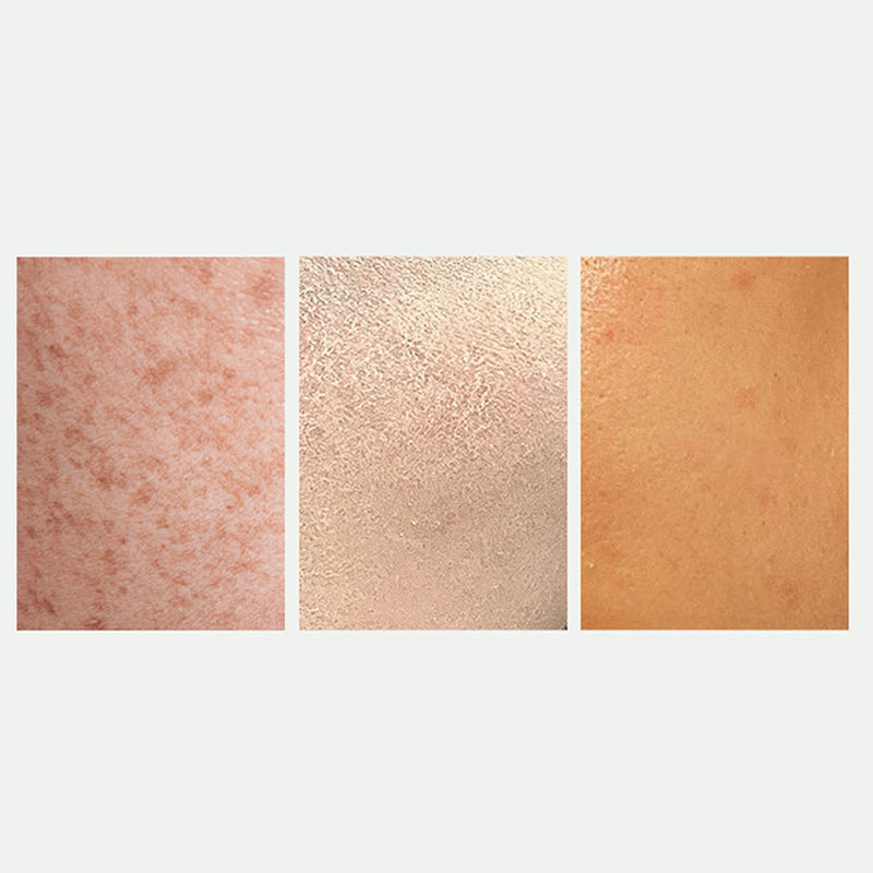 Aufhellendes Spray und Fleckenkorrektor für einen strahlenden Teint